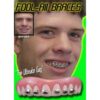 Billy Bob Teeth - Braces