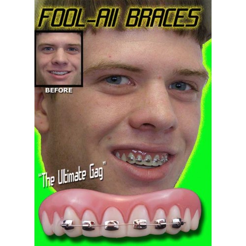 Billy Bob Teeth - Braces